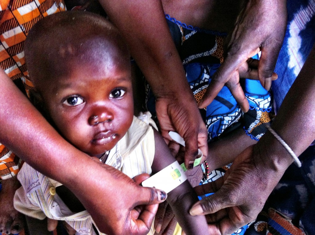 World Vision helps with Health checks for children